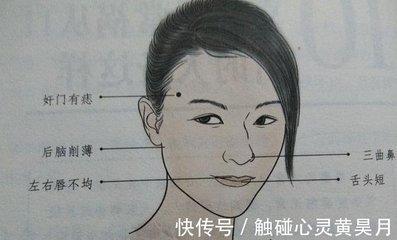 女人嘴唇有痣图解 女人嘴唇有痣会影响运势吗