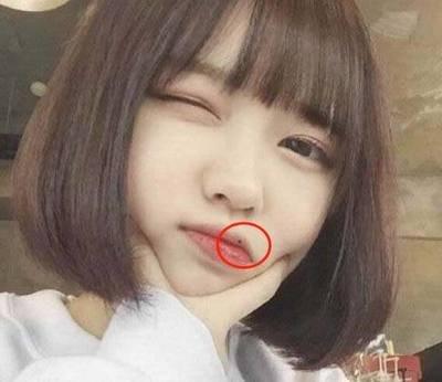 女人嘴巴左边的痣图解 女人嘴巴左边长痣好吗