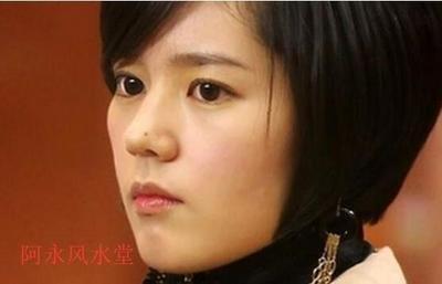 图解女人最有福气的3处吉痣 女人什么位置长痣好