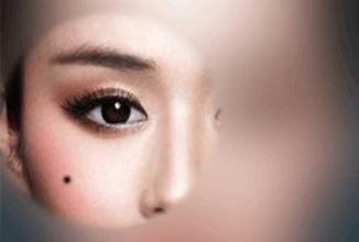 图解女人脸上长痣的吉凶 女人脸上长痣代表着什么