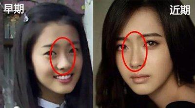 女人塌鼻梁不好看鼻梁塌面相女分析
