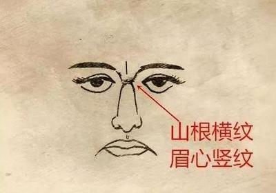 女人山根有横纹说明了什么 山根有横纹的女人运势如何