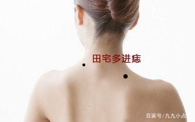 女人巨富痣有哪些 长在哪里的痣好