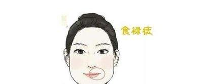 女性极好命的痣相 女人什么地方长痣好命