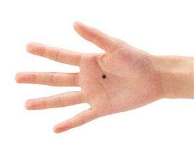 女人手背长痣是好是坏 女人手背长痣说明了什么