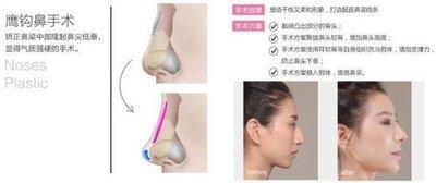 女人拥有鹰钩鼻好不好 女人有鹰钩鼻说明了什么