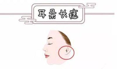 女性耳朵长痣面相图 女人耳朵长痣是什么意思