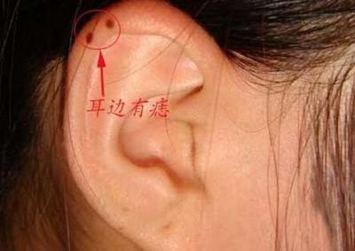 女性耳朵长痣面相图 女人耳朵长痣是什么意思