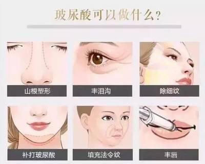 女人法令纹深代表什么 女性法令纹深有啥影响