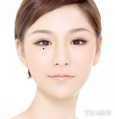 女生脸上有痣命运解析 脸上有痣的女人命好吗