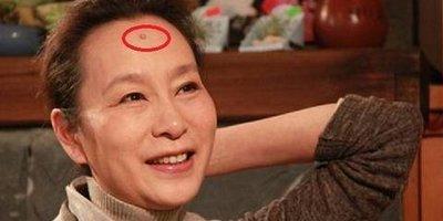 女生脸上的痣相图 女人脸上长痣分析