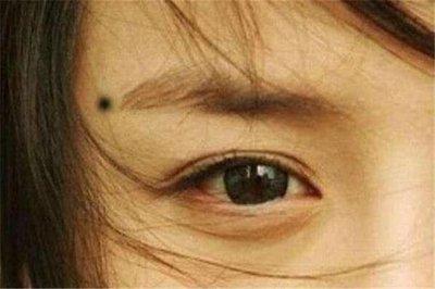 女人痣长在哪里最有福气 女人的痣长在什么地方好