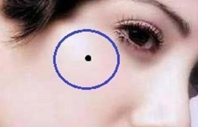 女人的富贵痣你有吗 女人哪几个地方长痣能富贵