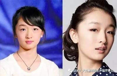 塌鼻子的女人面相真的不好吗 女人塌鼻子面相怎样