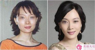 塌鼻子面相知多少 鼻子塌的人命运不好吗