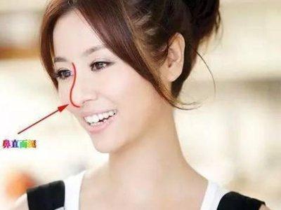 塌鼻梁的人命运如何 塌鼻梁说明了什么