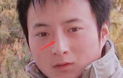 塌鼻梁的人是什么命运 看鼻梁塌的人命运是好还是坏