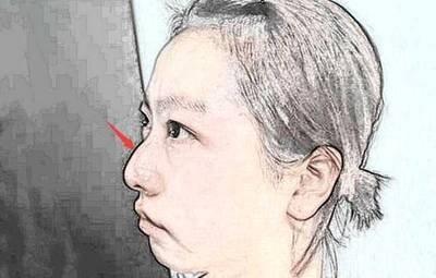 塌鼻梁的人面相如何 鼻梁塌的人命运怎么样