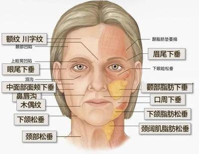 女人眉尾下垂面相解析 女人眉尾下垂是好还是不好