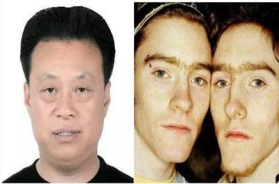 哪样面相的人吃软饭 面相得知会吃软饭的男人