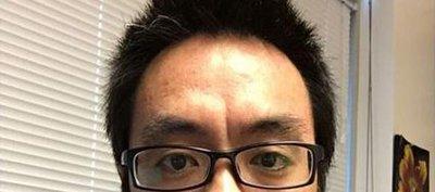 哪种印堂面相最糟糕 印堂怎样的人命运不好