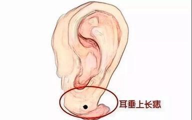 女人身上哪里长痣运势最好 女人哪些地方长痣代表好运