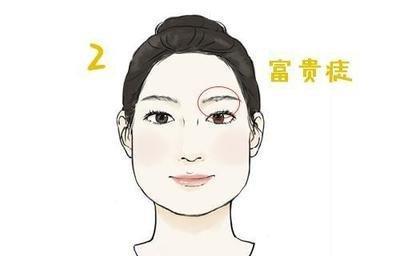 女人身上的几处好命富贵痣 女人的富贵痣长在哪里