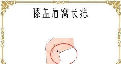 好命痣相  运势很好注定过上好的生活