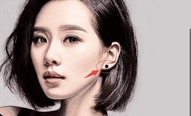 女人颈部三个痣相图解 女人的脖子上长痣好吗