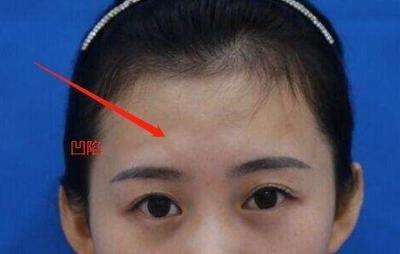 女人额头凹陷面相代表什么命运 女人额头凹陷好吗