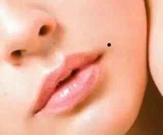 嘴唇上的痣可以去掉吗嘴唇长痣代表什么