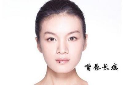 嘴唇上长痣的人命运怎么样  嘴唇有痣到底好不好