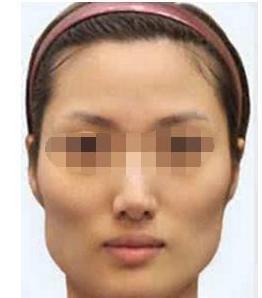 女人颧骨高面相好不好 女人颧骨高说明什么
