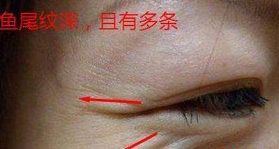女人鱼尾纹多面相意味着什么呢 看鱼尾纹多的女人一生