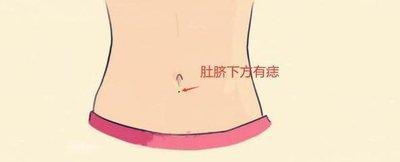 女人鼻尖有痣好吗 女人鼻子上长痣怎么样