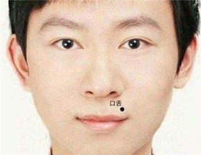 嘴巴周围有痣有什么含义 嘴巴长痣好吗