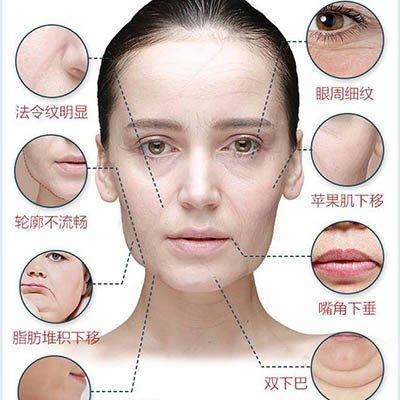 嘴角两边有法令纹了是怎么回事 嘴角有法令纹好不好