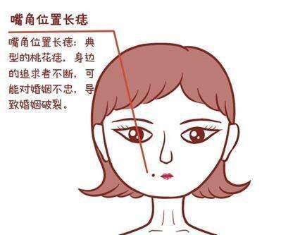 嘴角长痣代表什么运势 嘴角长痣的人命运好吗