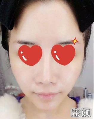 如何分析面相中的鱼尾纹 长有鱼尾纹好不好