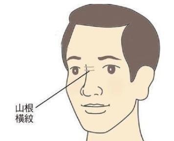 婚姻坎坷的面相有什么特征 哪几种面相的人婚姻不好