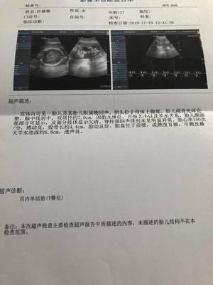 孕妇梦见胎动(孕妇梦见胎动突出小手)