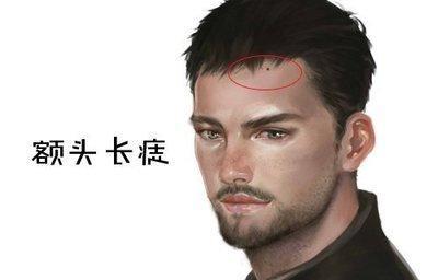 富贵痣男人的财运 男人什么地方长痣是富贵痣