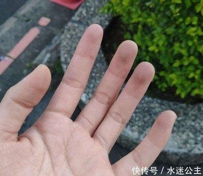 小拇指短会怎样 小拇指短的人命运好不好