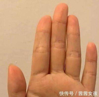 小拇指短的人命运好不好 小拇指短是什么意思