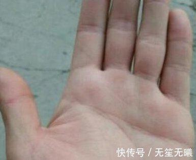 小拇指短的人运势好吗 小拇指短究竟是什么意思