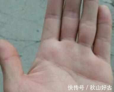 小拇指短的人运势好吗 小拇指短究竟是什么意思