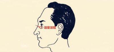 山根上有横纹是怎么回事 山根有横纹好吗