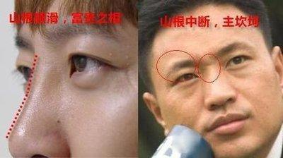 山根低的人命运真的不好吗 山根低意味着什么