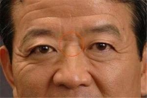 山根低的面相代表什么样的命运 山根低代表着什么