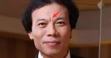 山根出现横纹代表了什么 山根有横纹的含义分析